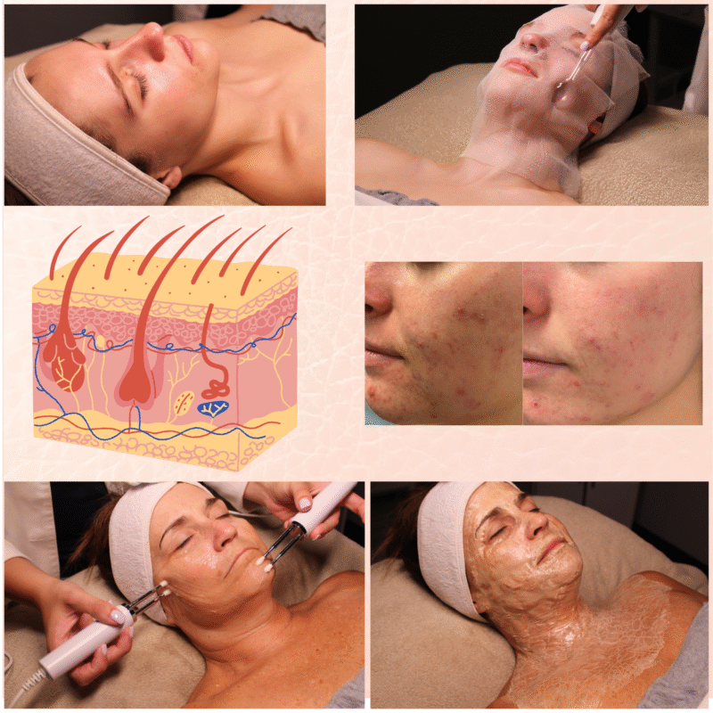 Intense Skin Therapy Training 5-Day Workshop